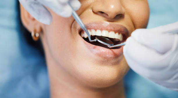 Best Emergency Root Canal Treatment in North Bonneville, WA